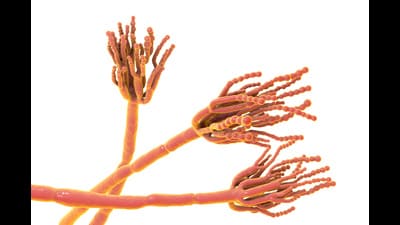 Spores of a penicillin fungus. (Adobe Stock)