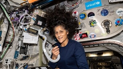 Sunita Williams will face several physical complications such as bone density loss, baby feet etc upon her return to Earth (X/@NASA) Sunita Williams will face several physical complications such as bone density loss, baby feet etc upon her return to Earth (X/@NASA)