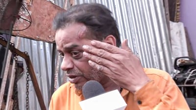 A man speaks to the media on his injuries after a clash broke out between two groups at Hansapuri area on March 17. (ANI ) A man speaks to the media on his injuries after a clash broke out between two groups at Hansapuri area on March 17. (ANI )