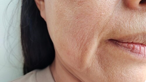 Stress can age the body faster. (Shutterstock) Stress can age the body faster. (Shutterstock)