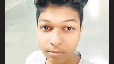 Andheri gas leak fire victim struggles with hospital bills Andheri gas leak fire victim struggles with hospital bills