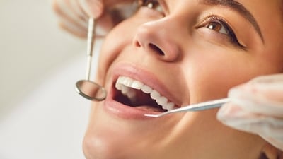 Know the myths vs. facts about teeth whitening. (Shutterstock) Know the myths vs. facts about teeth whitening. (Shutterstock)