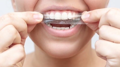 Teeth whitening is not permanent. (Shutterstock) Teeth whitening is not permanent. (Shutterstock)