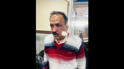 Injured Pradeep Guleria, a resident of Dayari, Tilli in Mandi district, told the police that on March 21 at around midnight two people – the rider was wearing a white cap while the pillion rider was in a black helmet -- came on a motorcycle and asked to pack the meal. (HT Photo)