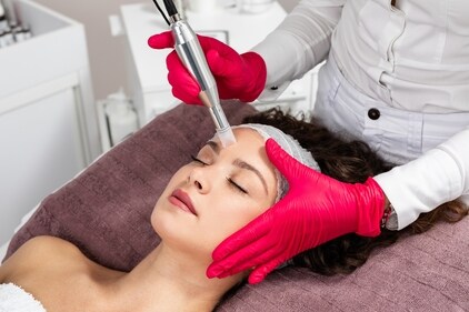 Microneedling is a foundational treatment that involves using fine needles to create tiny micro injuries in the skin (Photo: Adobe Stock)