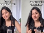 Check out the top superfoods for acne and oily, dry skin revealed by expert. Check out the top superfoods for acne and oily, dry skin revealed by expert.