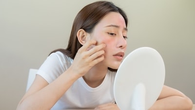 Skin barrier signs include redness, irritation and tightness. (Shutterstock) Skin barrier signs include redness, irritation and tightness. (Shutterstock)