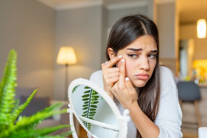 With uneven skin, you breakout more with damaged skin barrier. (Shutterstock) With uneven skin, you breakout more with damaged skin barrier. (Shutterstock)