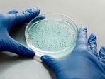 Deadly fungus C. auris is spreading rapidly in hospitals and nursing homes in the US