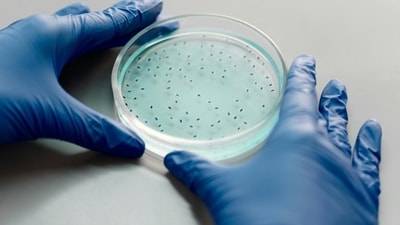 Deadly fungus C. auris is spreading rapidly in hospitals and nursing homes in the US (Representational Image) Deadly fungus C. auris is spreading rapidly in hospitals and nursing homes in the US (Representational Image)