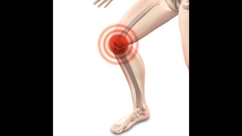 Stem cell therapy works as pain relief to heal knee joint swelling. (Image by naturwohl-gesundheit from Pixabay ) Stem cell therapy works as pain relief to heal knee joint swelling. (Image by naturwohl-gesundheit from Pixabay )
