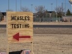 Measles outbreak in US: The child, who wasn’t vaccinated, had been hospitalized and was receiving treatment for complications from measles, according to an emailed statement from UMC Health System in Lubbock, Texas. The child had no known underlying health conditions, UMC said. Measles outbreak in US: The child, who wasn’t vaccinated, had been hospitalized and was receiving treatment for complications from measles, according to an emailed statement from UMC Health System in Lubbock, Texas. The child had no known underlying health conditions, UMC said.