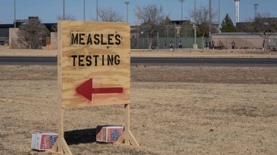 Measles outbreak in US: The child, who wasn’t vaccinated, had been hospitalized and was receiving treatment for complications from measles, according to an emailed statement from UMC Health System in Lubbock, Texas. The child had no known underlying health conditions, UMC said. (AFP) Measles outbreak in US: The child, who wasn’t vaccinated, had been hospitalized and was receiving treatment for complications from measles, according to an emailed statement from UMC Health System in Lubbock, Texas. The child had no known underlying health conditions, UMC said. (AFP)