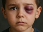 six-year-old boy's eye has been damaged after a Karnataka teacher allegedly threw a stick at him in the classroom. (Pic for representation)