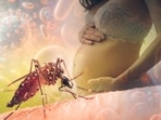 Malaria during pregnancy can cause health complications for both mother and child.