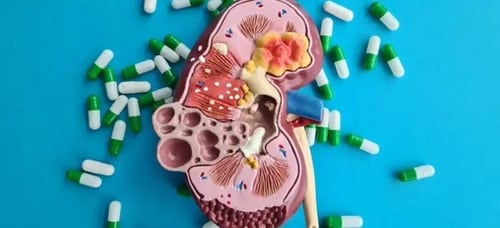 The toxins present within plastics can cause additional complications to the kidneys for individuals with existing kidney diseases. The toxins present within plastics can cause additional complications to the kidneys for individuals with existing kidney diseases.