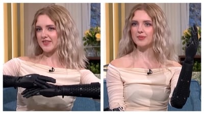 19-year-old Tilly from Bath wears the most advanced bionic arms. (PC: IG/@tilly.lockey) 19-year-old Tilly from Bath wears the most advanced bionic arms. (PC: IG/@tilly.lockey)