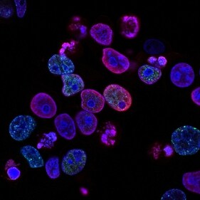 In some cancers, including leukemia in children and adolescents, obesity can negatively affect survival outcomes. (Unsplash) In some cancers, including leukemia in children and adolescents, obesity can negatively affect survival outcomes. (Unsplash)