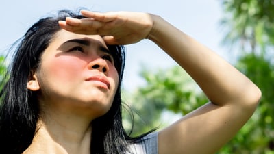 Sunburn, irritated skin may be the common skin concerns this summer, but did you know your hyperpigmentation also gets affected? (Shutterstock) Sunburn, irritated skin may be the common skin concerns this summer, but did you know your hyperpigmentation also gets affected? (Shutterstock)