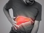 According to Dr. Adrian, high fructose corn syrup in processed foods is more harmful to liver health than traditional fats. According to Dr. Adrian, high fructose corn syrup in processed foods is more harmful to liver health than traditional fats.