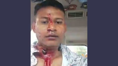Wing Commander Aditya Bose earlier claimed that he was attacked near the DRDO colony in CV Raman Nagar, (X/caimanemo333) Wing Commander Aditya Bose earlier claimed that he was attacked near the DRDO colony in CV Raman Nagar, (X/caimanemo333)