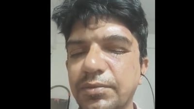 Bengaluru professor alleged that he was attacked by a group of men for asking them not to litter on roads. Bengaluru professor alleged that he was attacked by a group of men for asking them not to litter on roads.