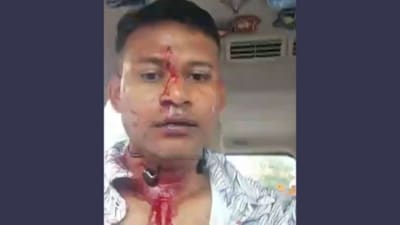 Wing Commander Shiladitya Bose shared a video on X in which he could be seen with blood on his face. (X) Wing Commander Shiladitya Bose shared a video on X in which he could be seen with blood on his face. (X)