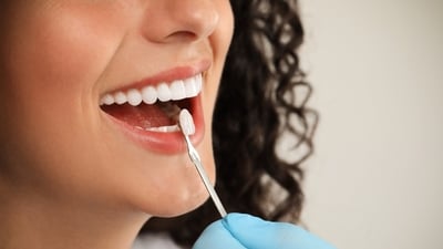 Summer season's effect on our oral health is often overlooked. (Shutterstock) Summer season's effect on our oral health is often overlooked. (Shutterstock)