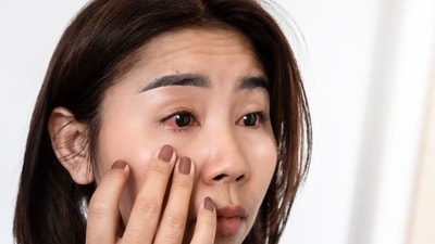 Menopause can lead to irritation, redness, a gritty sensation, and eye fatigue. (Shutterstock)