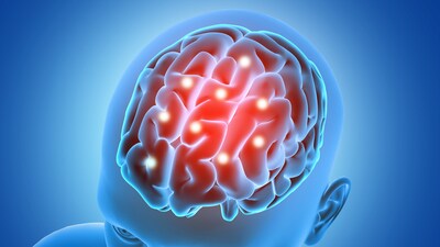 Keep your brain active and healthy with the help of diet. (Freepik) Keep your brain active and healthy with the help of diet. (Freepik)