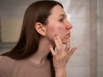 Dryness and redness are common signs of low Omega-3 levels. Dryness and redness are common signs of low Omega-3 levels.