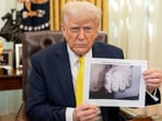 Trump appeared to show a digitally altered photo of Kilmar Abrego Garcia's tattoos Trump appeared to show a digitally altered photo of Kilmar Abrego Garcia's tattoos