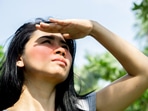  Can you imagine your scalp getting sunburnt? Well, it’s a realty.