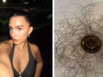 Kyle Richards' daughter, Sophia Umansky, opens up on shocking hair loss after taking a weight loss drug(TikTok/ Sophia Umansky)