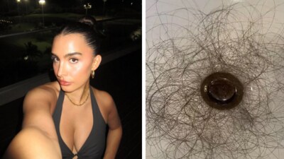 Kyle Richards' daughter, Sophia Umansky, opens up on shocking hair loss after taking a weight loss drug (TikTok/ Sophia Umansky)