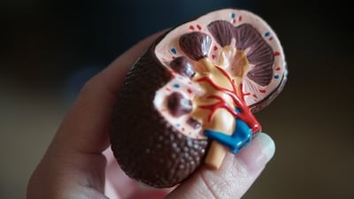 The risk of kidney stones gets accelerated in the summer season. (Unsplash) The risk of kidney stones gets accelerated in the summer season. (Unsplash)