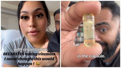 Dr Karan Rajan reacted a video in which a woman narrated how she ended up in the hospital due to the use of multivitamins. (Instagram/ Dr Karan Rajan) Dr Karan Rajan reacted a video in which a woman narrated how she ended up in the hospital due to the use of multivitamins. (Instagram/ Dr Karan Rajan)