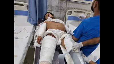 Injured Pawandeep undergoing treatment (HT Photo) Injured Pawandeep undergoing treatment (HT Photo)