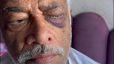 Lab investigation showed Rajendra Hardayal Guptawas suffering from an infection in his left eye caused by Pseudomonas aeruginosa – a virulent bacterium known to cause rapid and permanent vision loss if not treated promptly