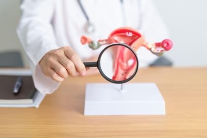 Ovarian cancer develops in the ovaries, fallopian tubes, or lining of the abdomen. (Shutterstock) Ovarian cancer develops in the ovaries, fallopian tubes, or lining of the abdomen. (Shutterstock)