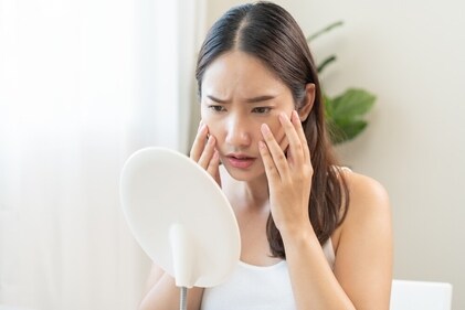 People with dry skin need rich creams to be hydrated. (Shutterstock) People with dry skin need rich creams to be hydrated. (Shutterstock)