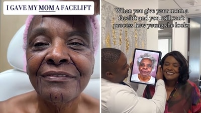 Linda Truesdale who got dramatic plastic surgery from her son Dr Carl Truesdale. (Instagram/@doctor.truesdale) Linda Truesdale who got dramatic plastic surgery from her son Dr Carl Truesdale. (Instagram/@doctor.truesdale)