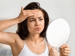 Hairline acne occurs on the forehead, near the scalp.