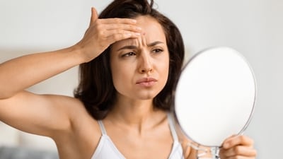 Hairline acne occurs on the forehead, near the scalp. (Shutterstock) Hairline acne occurs on the forehead, near the scalp. (Shutterstock)