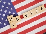 Iris Goldsztajn faced visa challenges after graduating from UCLA, losing her dream job in the U.S. Iris Goldsztajn faced visa challenges after graduating from UCLA, losing her dream job in the U.S.