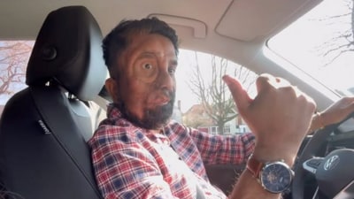 Amit Ghose is a motivational speaker who was born with Neurofibromatosis type 1, a condition that causes non-cancerous tumours. (Instagram/amitghosenf1) Amit Ghose is a motivational speaker who was born with Neurofibromatosis type 1, a condition that causes non-cancerous tumours. (Instagram/amitghosenf1)