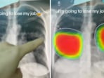 The doctor showed that AI was able to make the same deductions as him in seconds. The doctor showed that AI was able to make the same deductions as him in seconds.