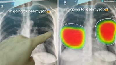 The doctor showed that AI was able to make the same deductions as him in seconds. (Instagram/drfawzikatranji) The doctor showed that AI was able to make the same deductions as him in seconds. (Instagram/drfawzikatranji)