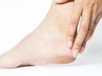 Nutritionist reveals how foot symptoms indicate hidden health issues. Nutritionist reveals how foot symptoms indicate hidden health issues.