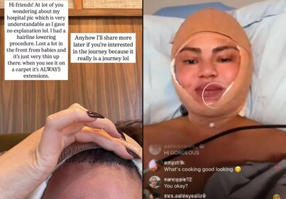 Chrissy Teigen on her Instagram Stories Chrissy Teigen on her Instagram Stories